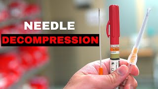 How To Chest Needle Decompression [upl. by Beaufort352]