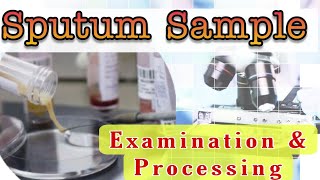 Sputum Sample Examination amp Processing [upl. by Eiramadnil911]