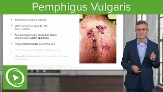 Pemphigus Vulgaris – Dermatology  Lecturio [upl. by Odlareg]