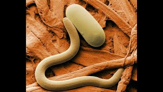 What are nematodes [upl. by Ettezus]