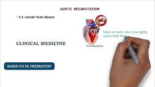 What is aortic regurgitation [upl. by Triny953]