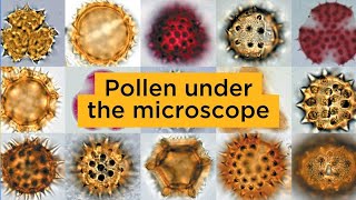 Pollen under the microscope [upl. by Newlin]