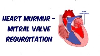 Mitral Regurgitation  Auscultation Sound [upl. by Adena]