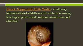 Otitis Externa and Otitis Media [upl. by Rebekah562]