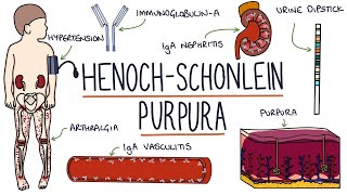 HenochSchonlein Purpura Visual Explanation for Students [upl. by Airdnat]