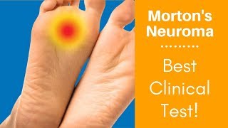 Mortons Neuroma Best Clinical Test [upl. by Bartholemy]