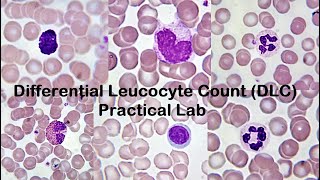 Differential Leucocyte Count DLC Practical Lab [upl. by Rowe590]