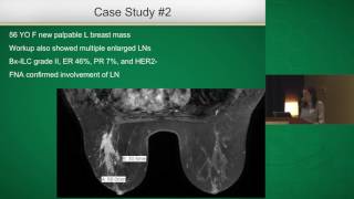 Breast Cancer Surgical Margins [upl. by Ciryl]