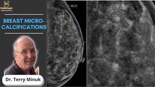 How to Lower Your Calcium Score Part 1 Root Causes amp Vitamin D [upl. by Pernick355]