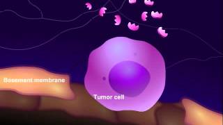 Introduction to Cancer Biology Part 3 Tissue Invasion and Metastasis [upl. by Pate]