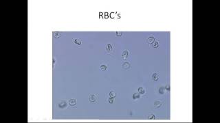 Microscopic Urinalysis [upl. by Anum]