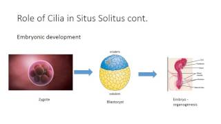 Situs inversus [upl. by Latsirc448]