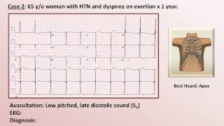 EKG and Heart Murmur Review  Part 1 [upl. by Stoneham350]