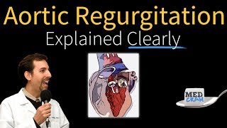 Mitral Valve Stenosis Diagnosis Treatment Pathophysiology [upl. by Vanhomrigh]