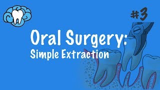 Oral Surgery  Simple Extraction  INBDE ADAT [upl. by Iblehs447]