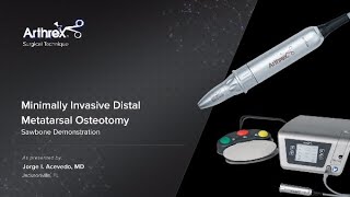 Minimally Invasive Distal Metatarsal Osteotomy [upl. by Gerome]