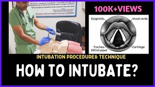 HOW TO INTUBATE INTUBATION PROCEDURE amp TECHNIQUE [upl. by Bluhm]