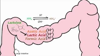 Hepatic Encephalopathy and Lactulose [upl. by Esmond]