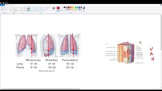 Thoracentesis Quick Review [upl. by Otreblon856]