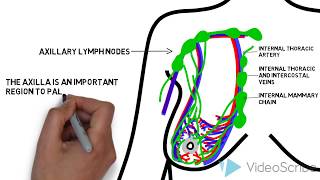 The Basics of Breast Cancer 5 Ws [upl. by Tupler]